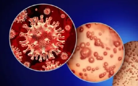 الهيئة الصحية في الاتحاد الإفريقي تعلن جدري القردة "حالة طوارئ صحية عامة"