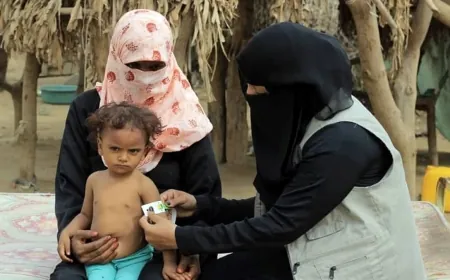 الأمم المتحدة: سوء التغذية يتفاقم في مناطق سيطرة الحكومة اليمنية