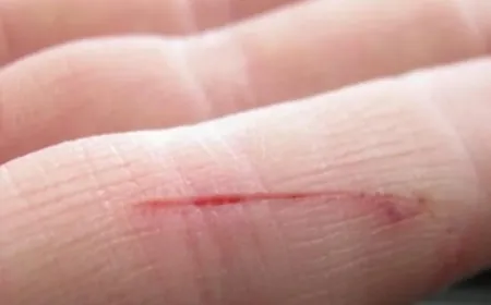 لعلاج الجروح .. ضمادة كهربائية تعمل بالماء