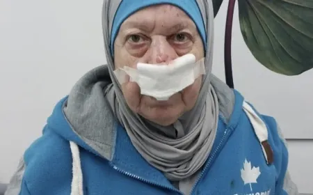 جـريمة في وضح النهار: اعـتداء وسرقة في المعرض وسط غياب الأمن