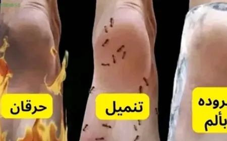 ما العلاقة بين التنميل والحرقان في القدمين والنظام الغذائي؟