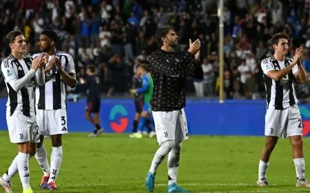 جوفنتوس يضم لاعب نيوكاسل يونايتد