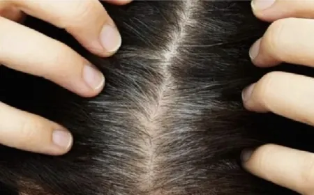 "شيب الشعر".. كيف يتوقف؟