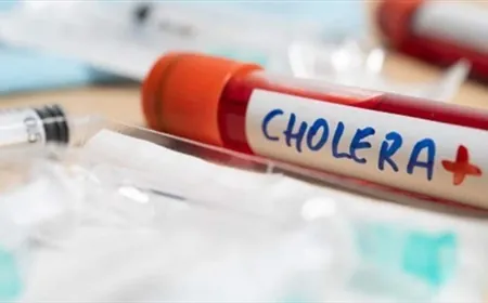 وفاة 70 شخصا في السودان خلال اسبوع جراء الكوليرا