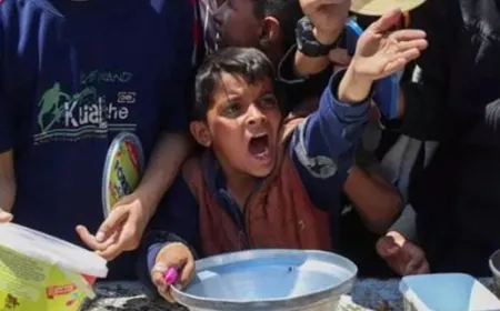 بسبب سوء التغذية في غزة.. ارتفاع وفيات الأطفال إلى 66