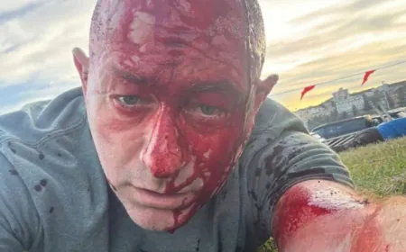 من بين المصابين رئيس المجلس اليهودي الإسرائيلي الأسترالي