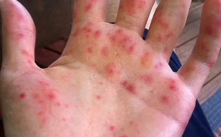 التفتيش المركزي يفتح تحقيقاً عاجلاً بشأن انتشار الحمى القلاعية بين الأبقار في لبنان  تبيّن لمفتشي التفتيش المركزي صحة بعض المعطيات المتداولة