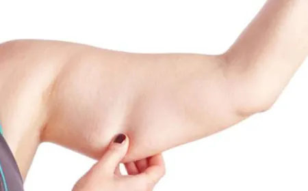 هل يؤرقكِ ظهور ترهلات تظهر أسفل منطقة الذراعين؟. هناك العديد من الأسباب التي تؤدي إلى ظهور الزنود وهي الترهلات أسفل منطقة الذراعين... تعرفي عليها الآن..مع أسرع طرق لتنحيفها