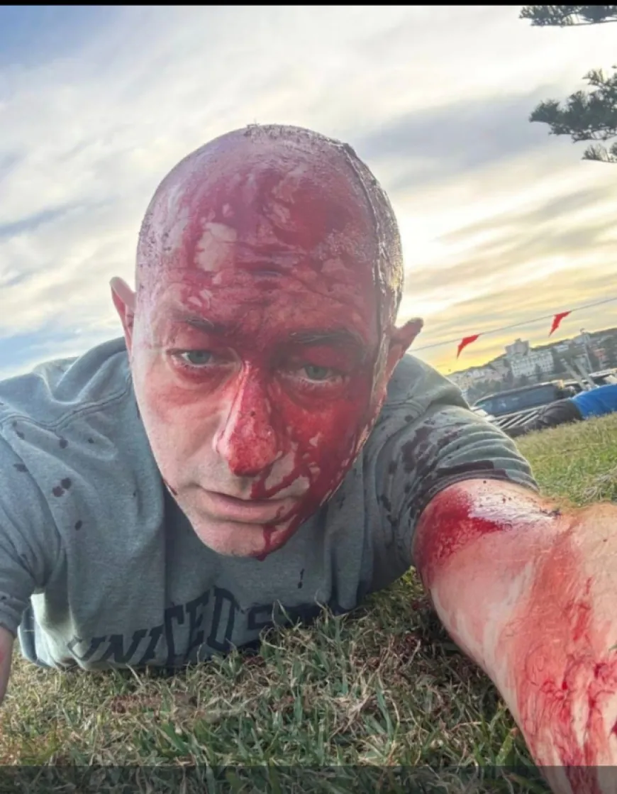 من بين المصابين رئيس المجلس اليهودي الإسرائيلي الأسترالي