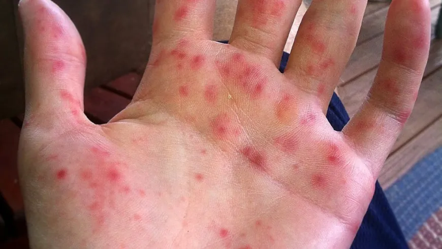 التفتيش المركزي يفتح تحقيقاً عاجلاً بشأن انتشار الحمى القلاعية بين الأبقار في لبنان  تبيّن لمفتشي التفتيش المركزي صحة بعض المعطيات المتداولة